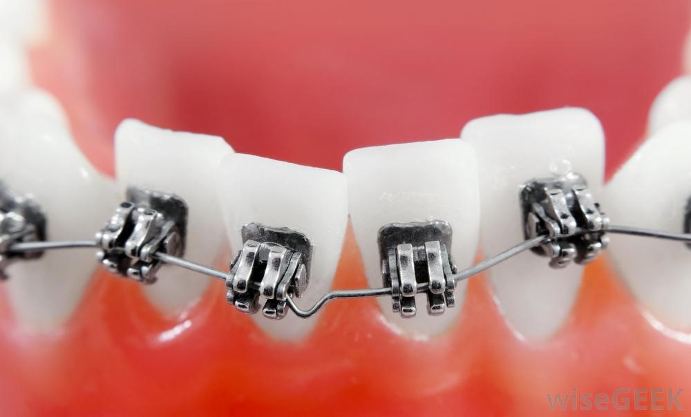 مشکلات ناشی از عارضه های فکی و دندانی