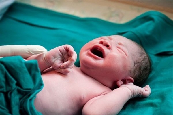 سندرم «پیررابین» چه عارضه هایی در نوزادان دارد