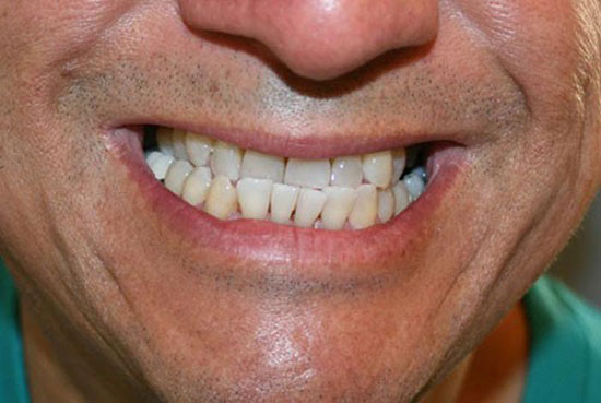 درمان ناهنجاری‌های فک و دندان با ارتودنسی امکان پذیر است