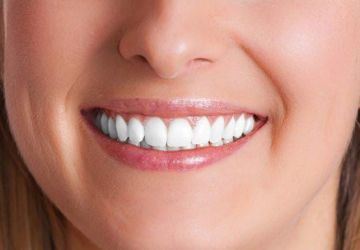 نکات مهم در بلیچینگ دندان