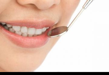 بهترین مارک کامپوزیت دندان چیست؟