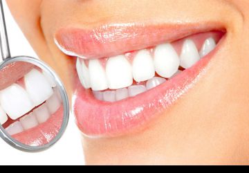 آیا از صفر تا صد بلیچینگ دندان خبر دارید؟