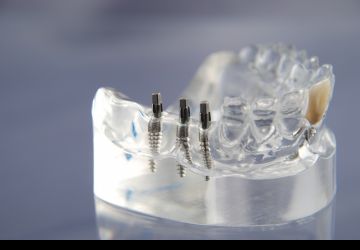 لق شدن ایمپلنت دندان به چه دلایلی اتفاق می‌افتد؟