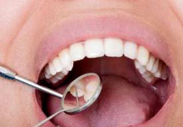 درمان لق شدن ایمپلنت دندان