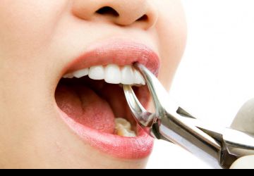 کشیدن دندان بهتراست یا درمان ریشه؟