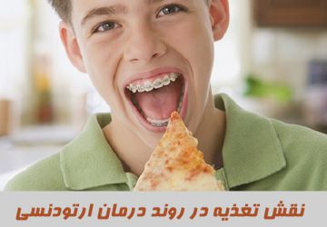 آیا تغذیه در روند درمان ارتودنسی نقش دارد؟