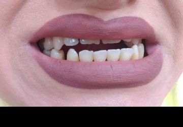 ناهنجاریهای دندان