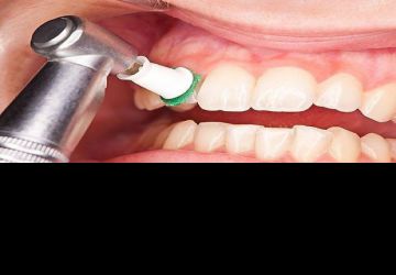 چرا جرم دندان به وجود می آید؟