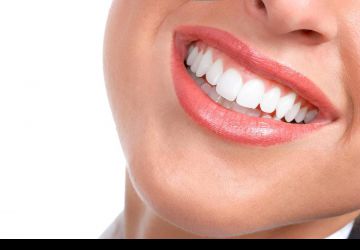 درباره لامینیت دندان چه می دانیم؟
